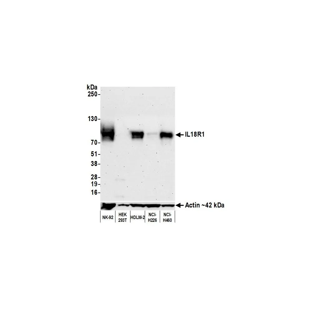 Rabbit anti-IL18R1 Recombinant Monoclonal Antibody [BLR172J]