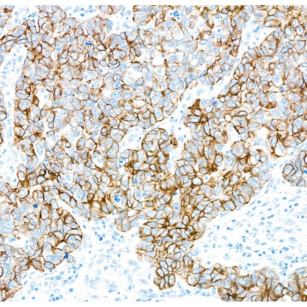 Rabbit anti-CK7 Recombinant Monoclonal Antibody [BC1]