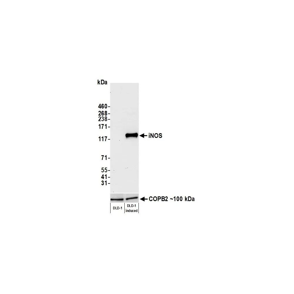 Rabbit anti-iNOS Recombinant Monoclonal Antibody [BLR188J]