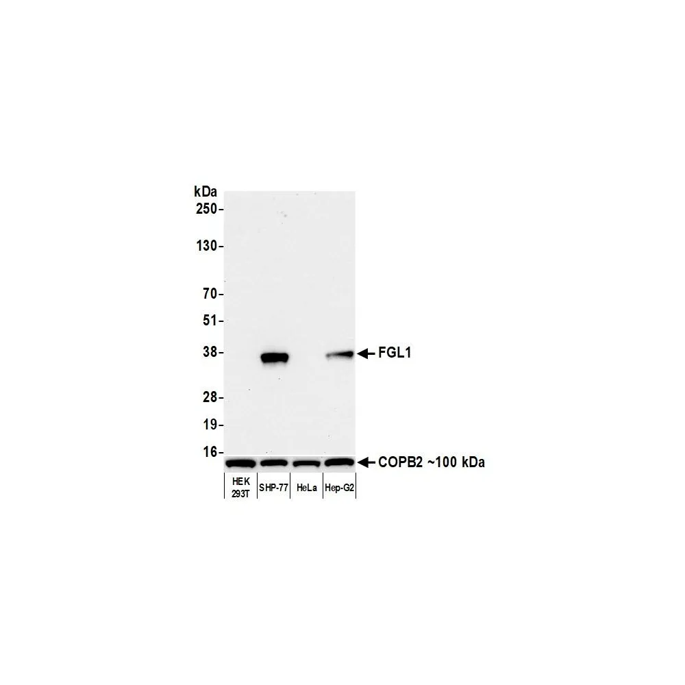 Rabbit anti-Hepassocin/FGL1 Recombinant Monoclonal Antibody [BLR210K]