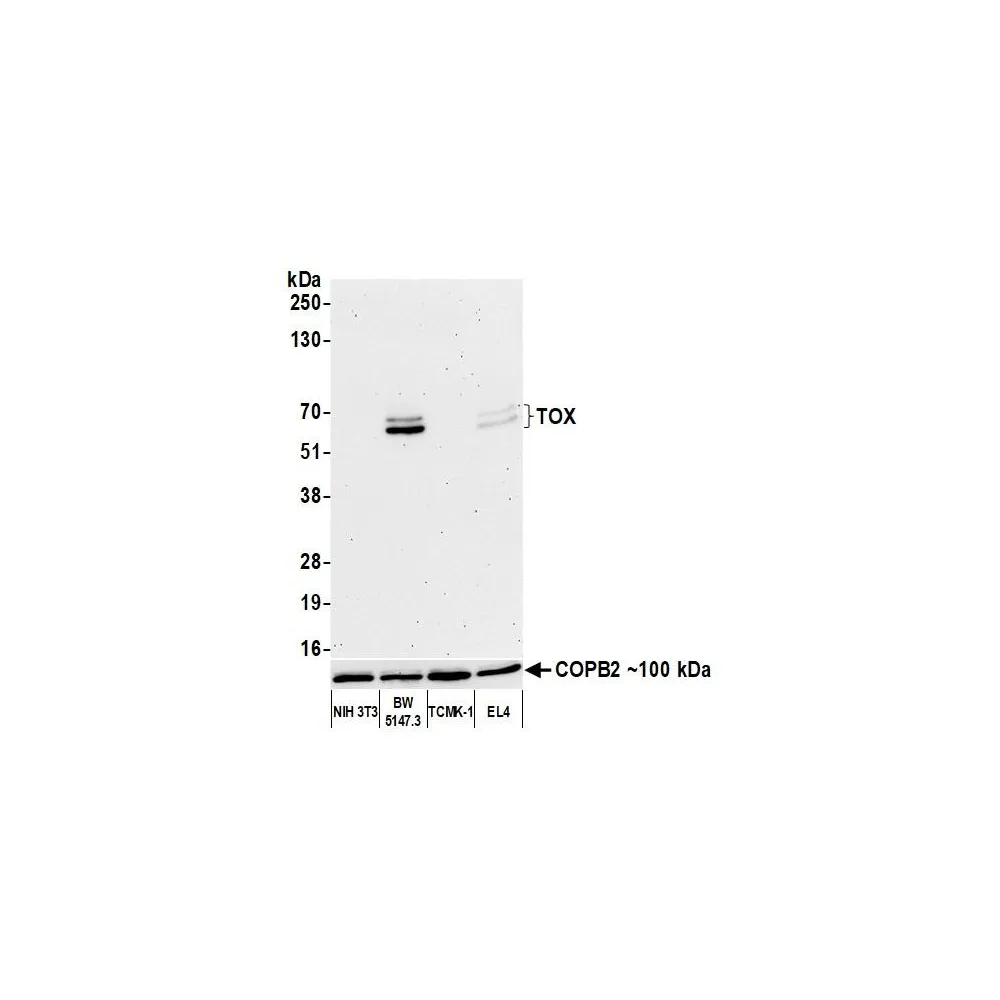 Rabbit anti-TOX Recombinant Monoclonal Antibody [BLR212K]