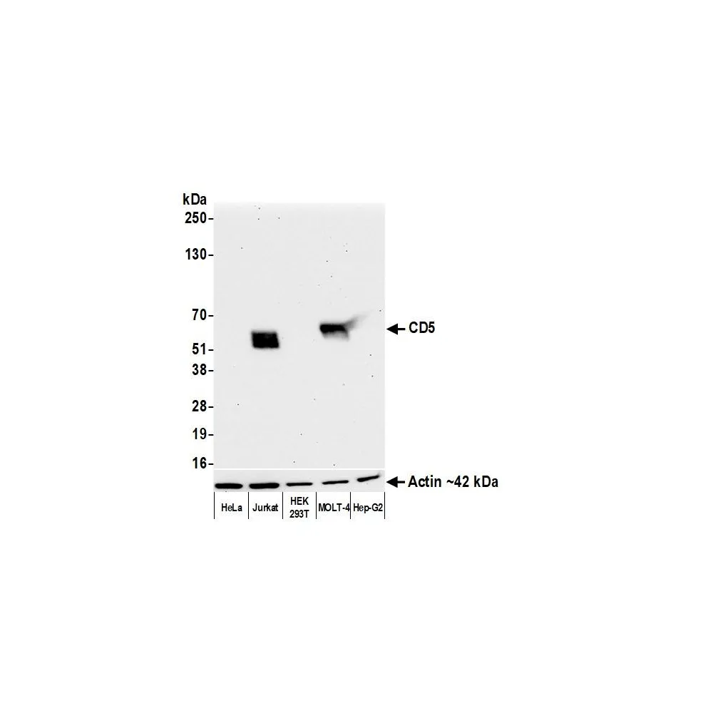 Rabbit anti-CD5 Recombinant Monoclonal Antibody [BLR218K]