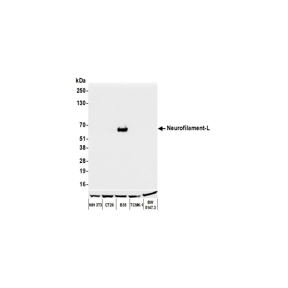 Rabbit anti-Neurofilament-L Recombinant Monoclonal Antibody [BLR224K]