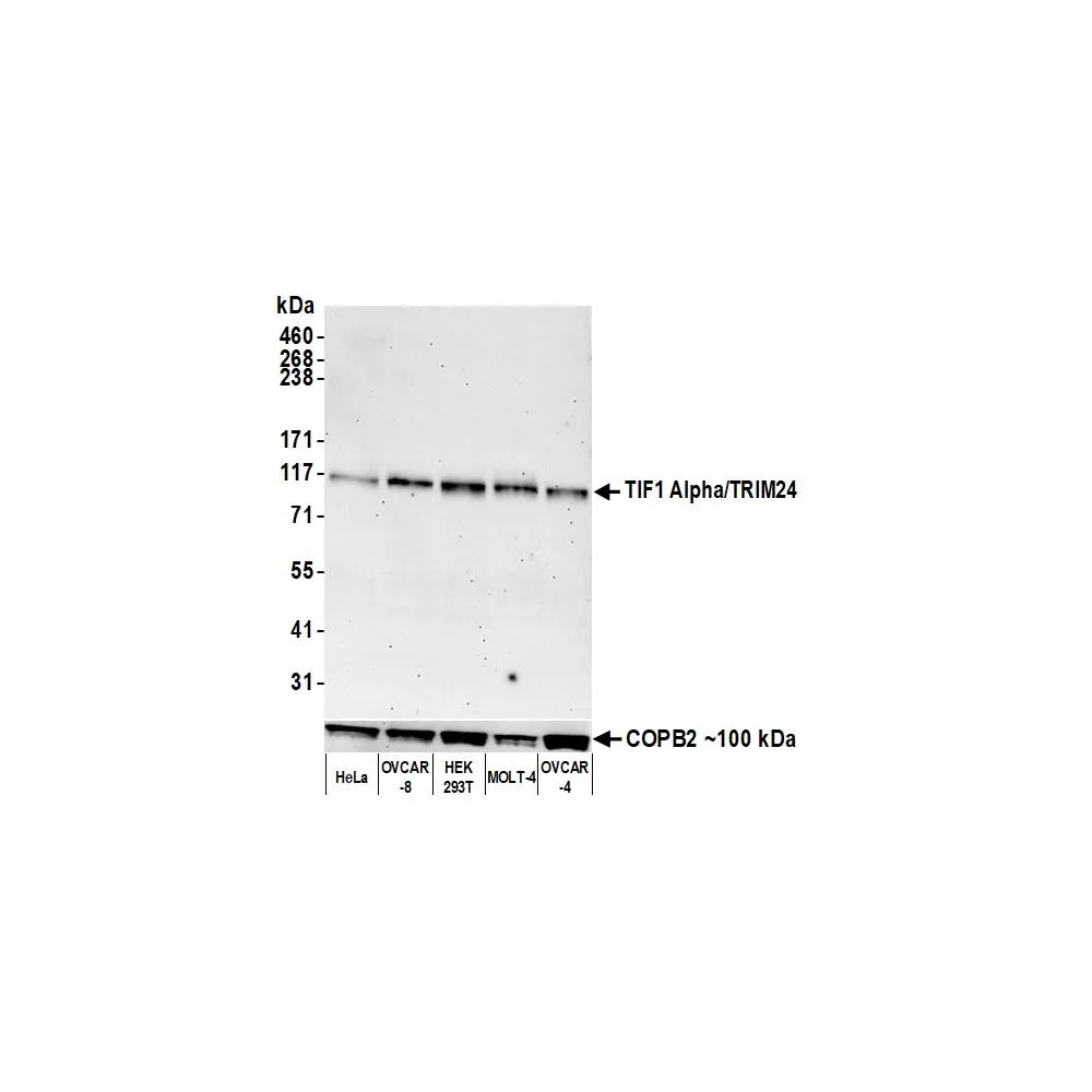 Rabbit anti-TIF1 Alpha/TRIM24 Recombinant Monoclonal Antibody [BLR225K]