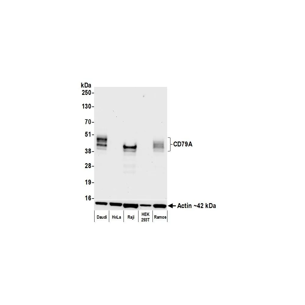 Rabbit anti-CD79A Recombinant Monoclonal Antibody [BLR232K]