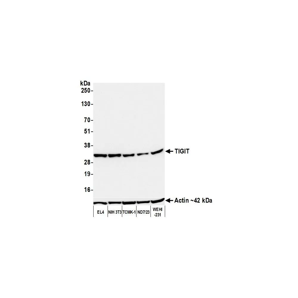 Rabbit anti-TIGIT Recombinant Monoclonal Antibody [BLR235K]