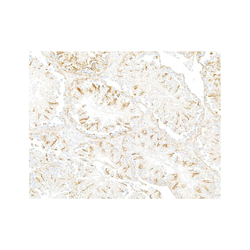 Rabbit anti-beta-Tubulin Recombinant Monoclonal Antibody [BLR236K]