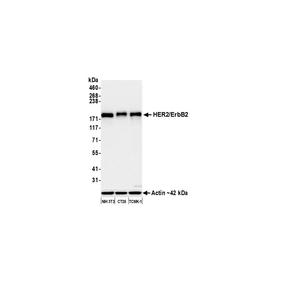 Rabbit anti-HER2/ErbB2 Recombinant Monoclonal Antibody [BLR241L]