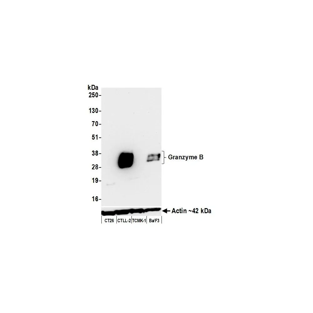Rabbit anti-Granzyme B Recombinant Monoclonal Antibody [BLR244L]