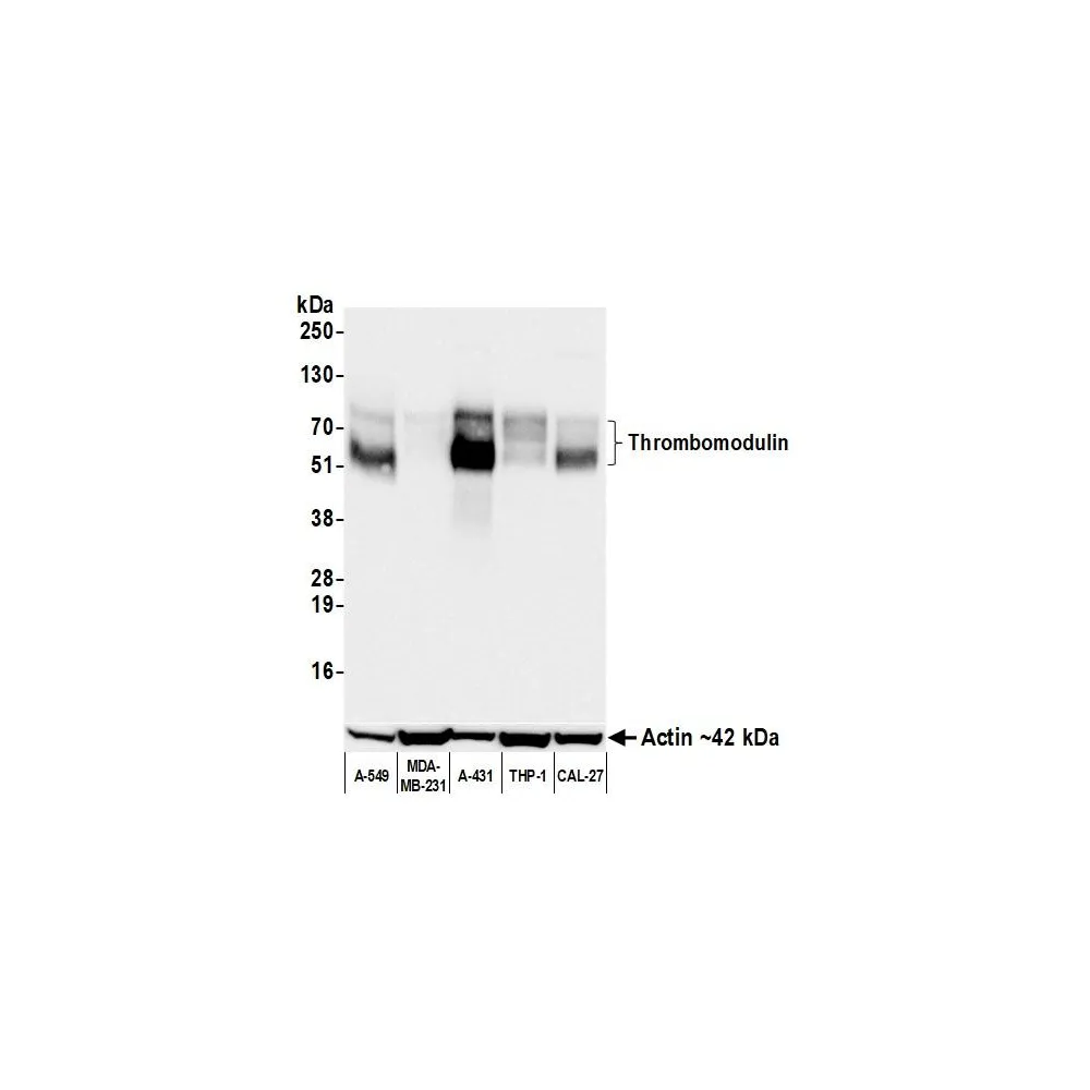 Rabbit anti-Thrombomodulin Recombinant Monoclonal Antibody [BLR253L]