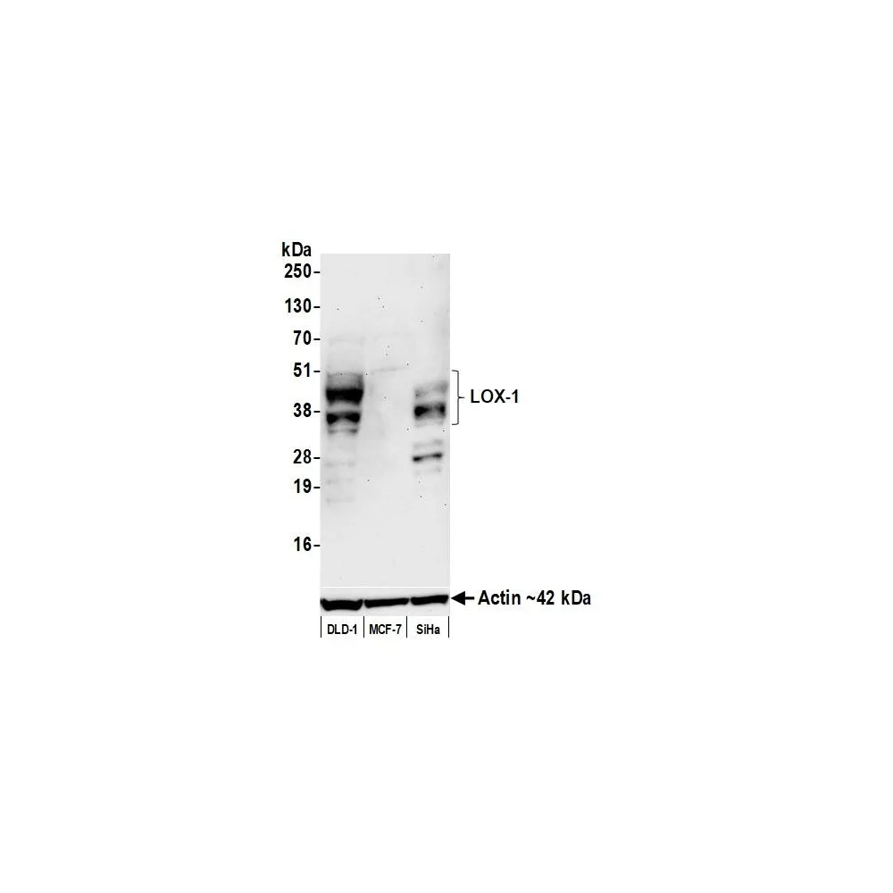 Rabbit anti-LOX-1 Recombinant Monoclonal Antibody [BLR262L]