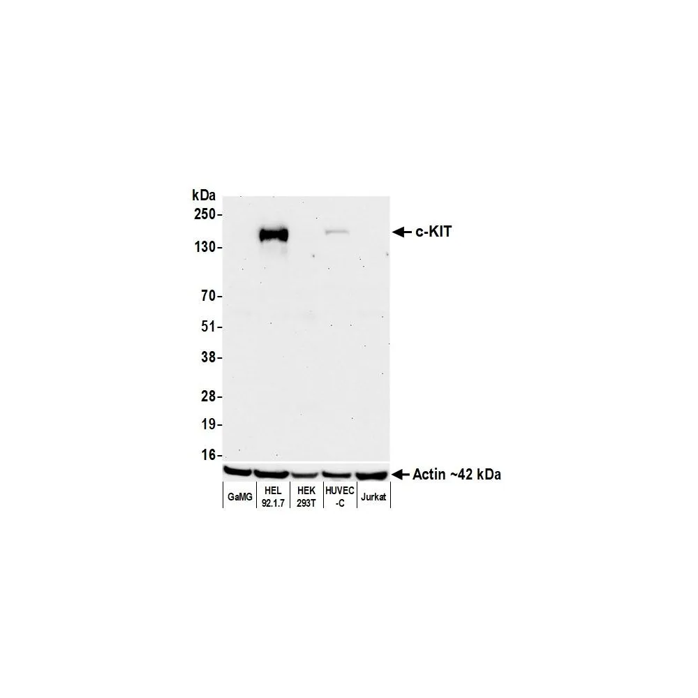 Rabbit anti-c-Kit Recombinant Monoclonal Antibody [BLR263L]