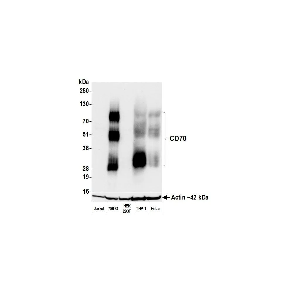 Rabbit anti-CD70 Recombinant Monoclonal Antibody [BLR266L]