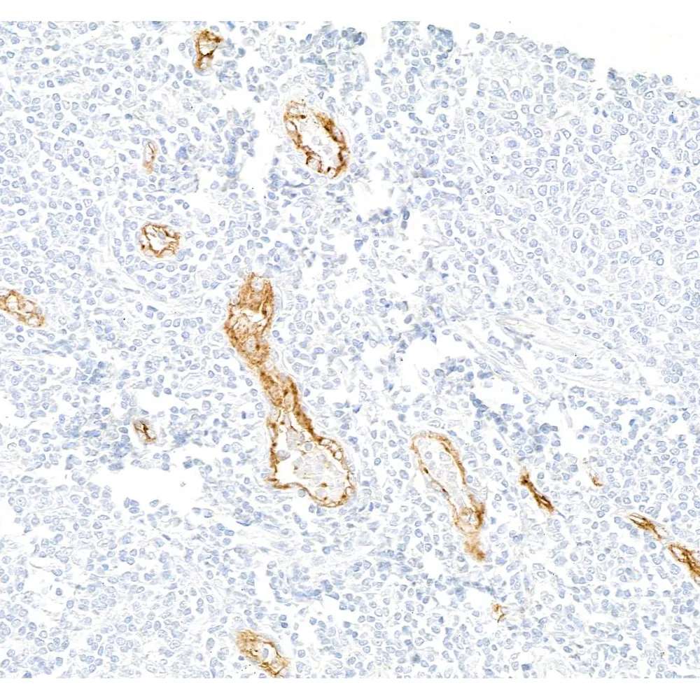 Rabbit anti-P-Selectin/CD62P Recombinant Monoclonal Antibody [BLR268L]
