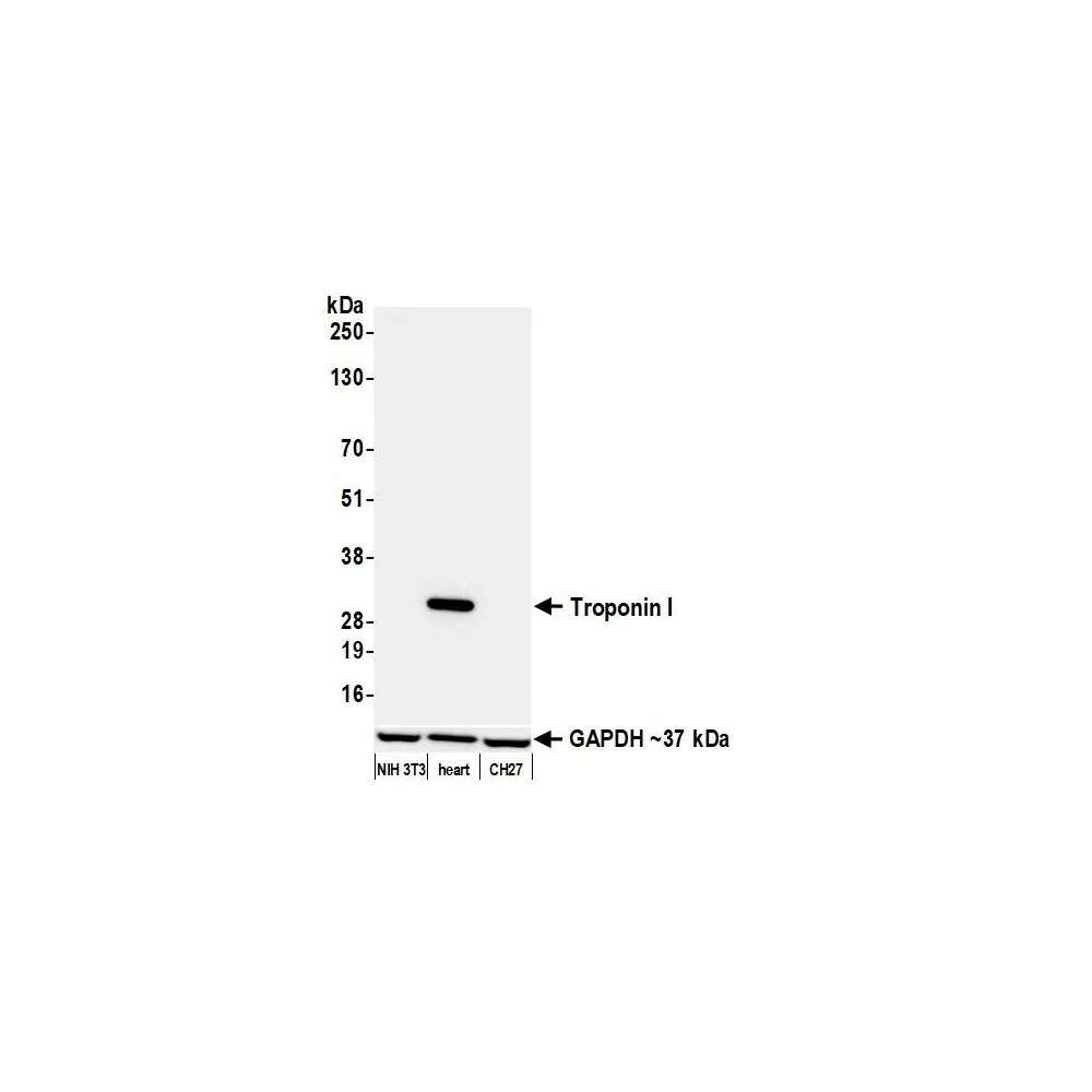 Rabbit anti-Troponin I Recombinant Monoclonal Antibody [BLR280L]