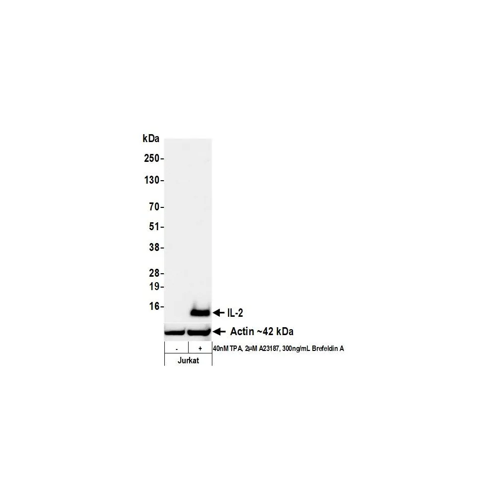 Rabbit anti-IL-2 Recombinant Monoclonal Antibody [BLR287L]