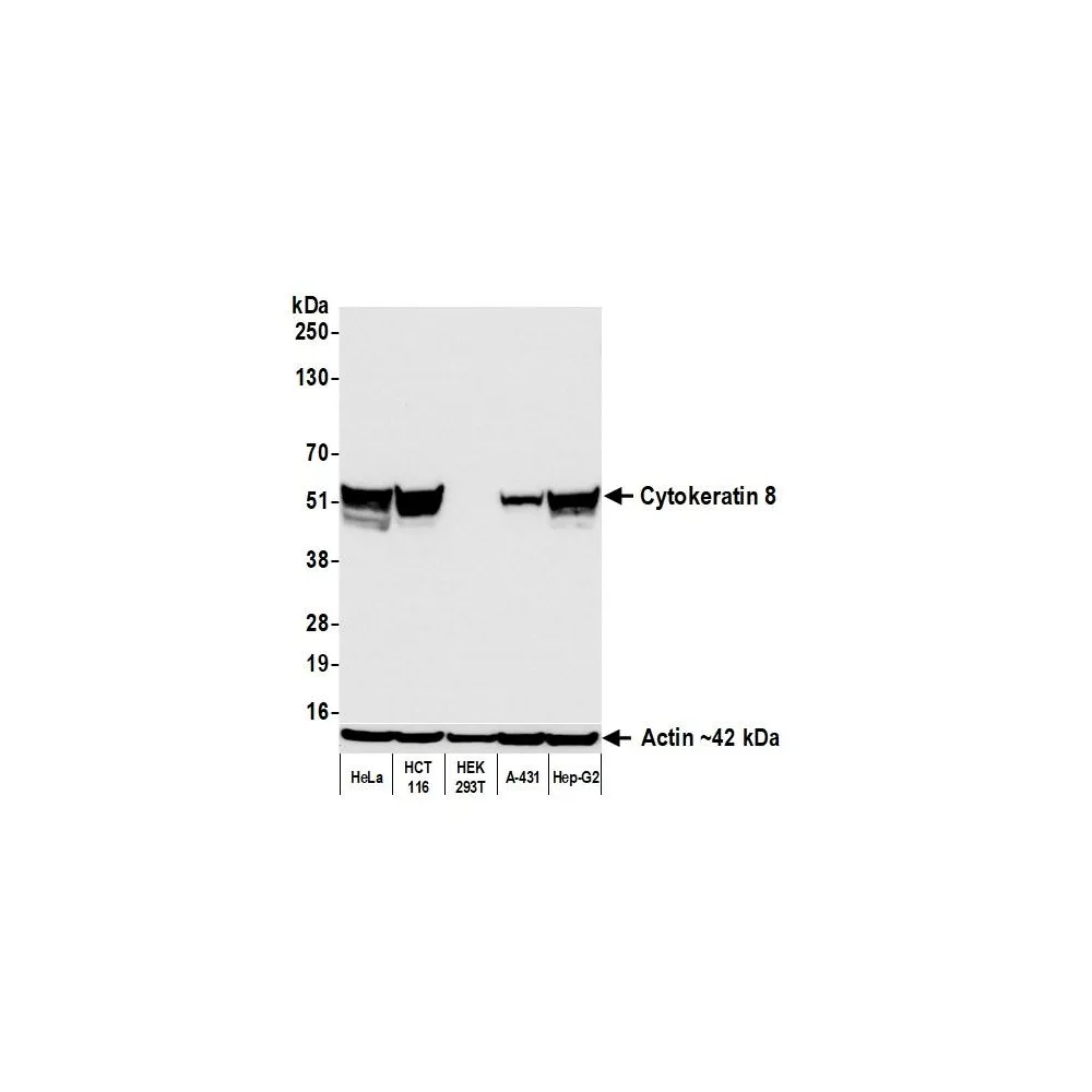 Rabbit anti-Cytokeratin 8 Recombinant Monoclonal Antibody [BLR299M]