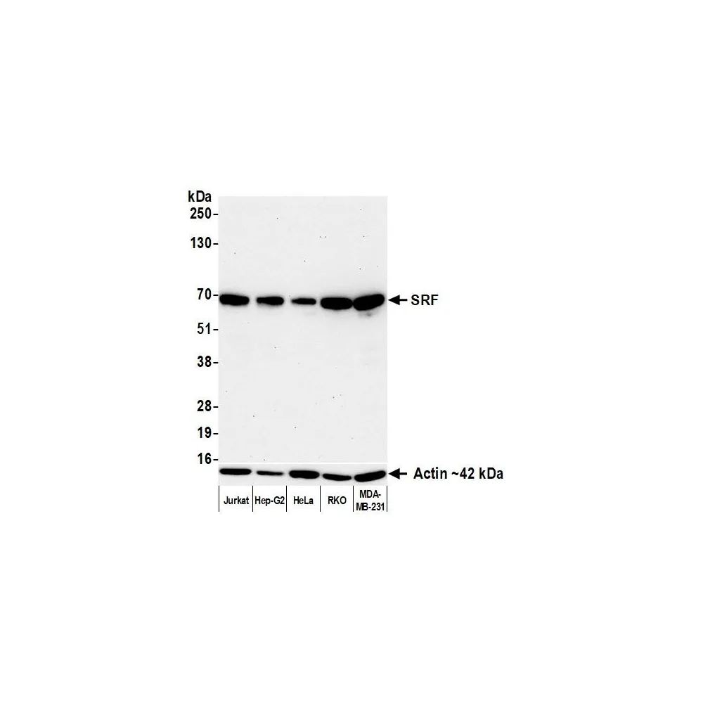Rabbit anti-SRF Recombinant Monoclonal Antibody [BLR308M]