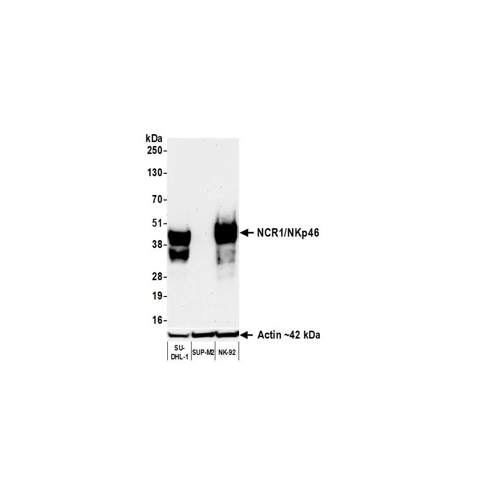 Rabbit anti-NCR1/NKp46 Recombinant Monoclonal Antibody [BLR309M]