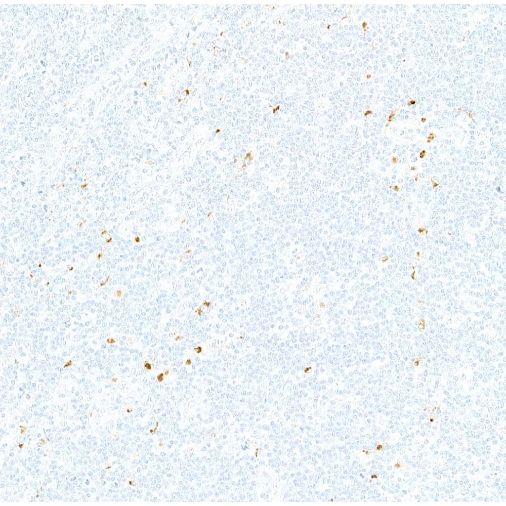 Rabbit anti-IL-10 Recombinant Monoclonal Antibody [BLR317M]