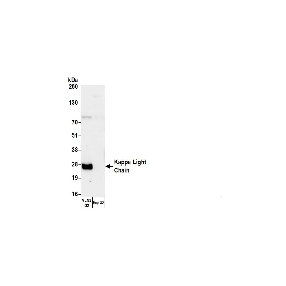 Goat anti-Human Kappa Light Chain Antibody FITC Conjugated