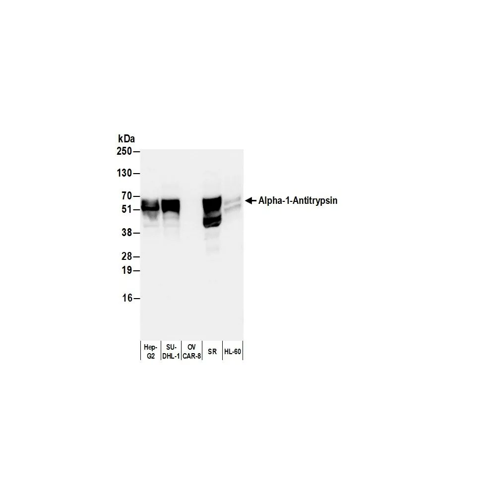 Goat anti-Human Alpha-1-Antitrypsin Antibody FITC Conjugated