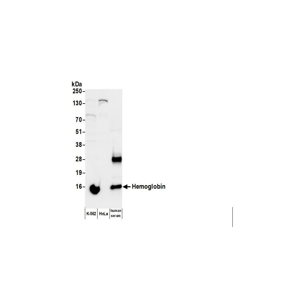 Goat anti-Human Hemoglobin Antibody FITC Conjugated