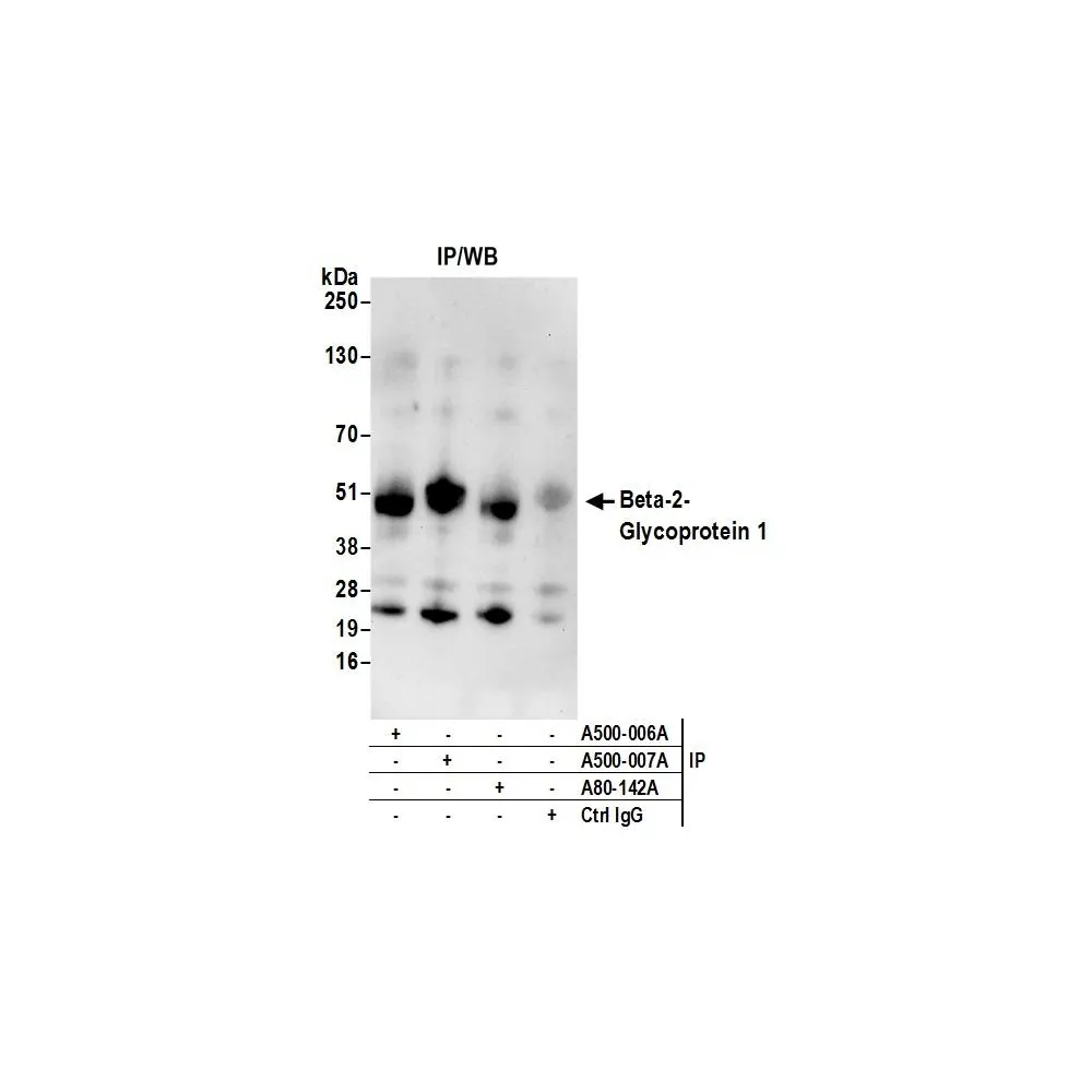 Goat anti-Human Beta-2 Glycoprotein 1 Antibody, Affinity Purified