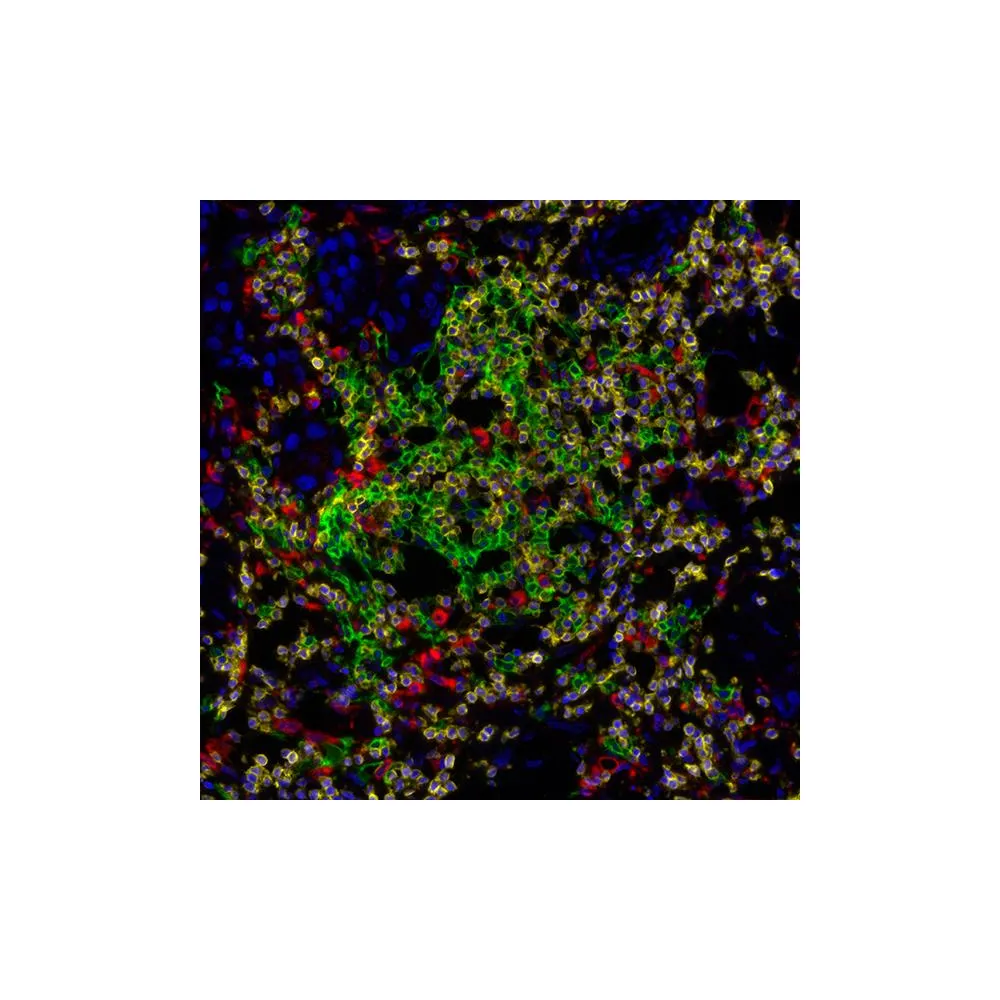 Immune Localization PathPlex® Panel (CD3E, CD68, CD20)