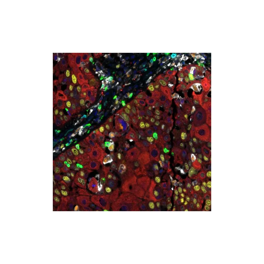 Activated T Cell PathPlex® Panel (CD3E, Cytokeratin, CD8 alpha, CD68, Ki-67, PD-L1)