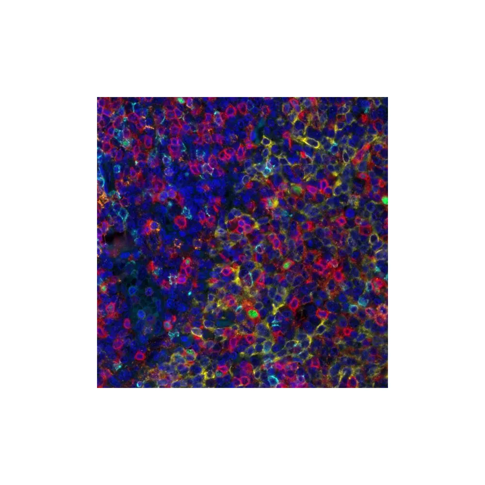 T Cell Maturation PathPlex® Panel (CD8 alpha, Cytokeratin, CD45RO, CD4, FOXP3)