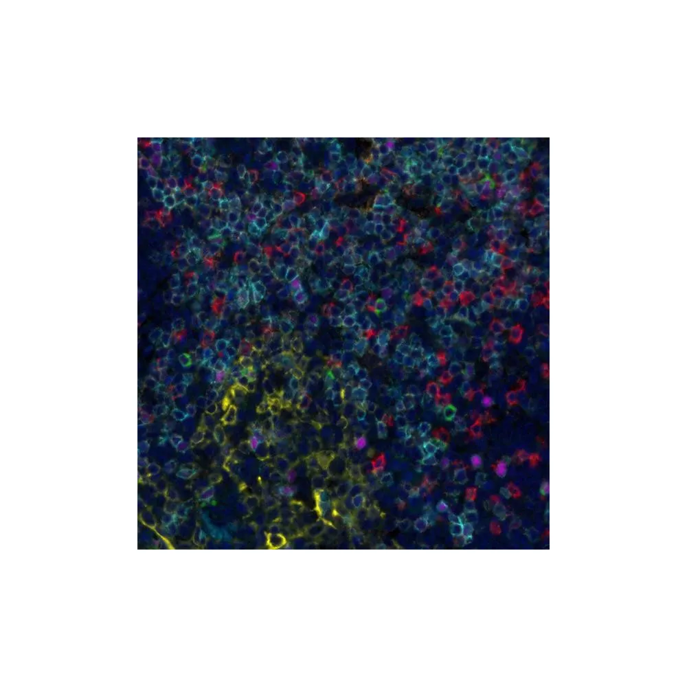 T Cell Status PathPlex® Panel (CD3E, Cytokeratin, CD8 alpha, CD4, LAG3, FOXP3)