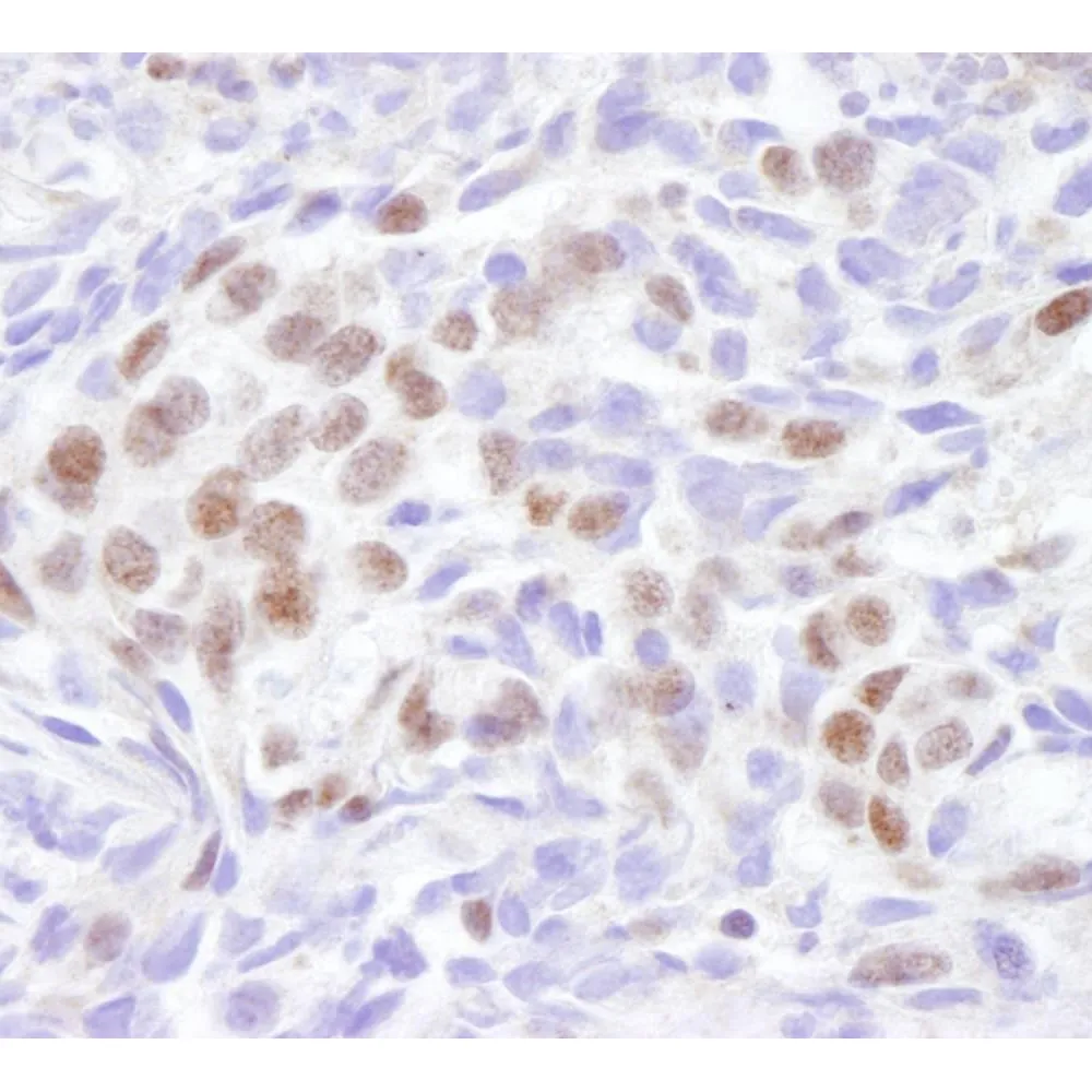 Rabbit anti-EDD1 IHC Antibody, Affinity Purified
