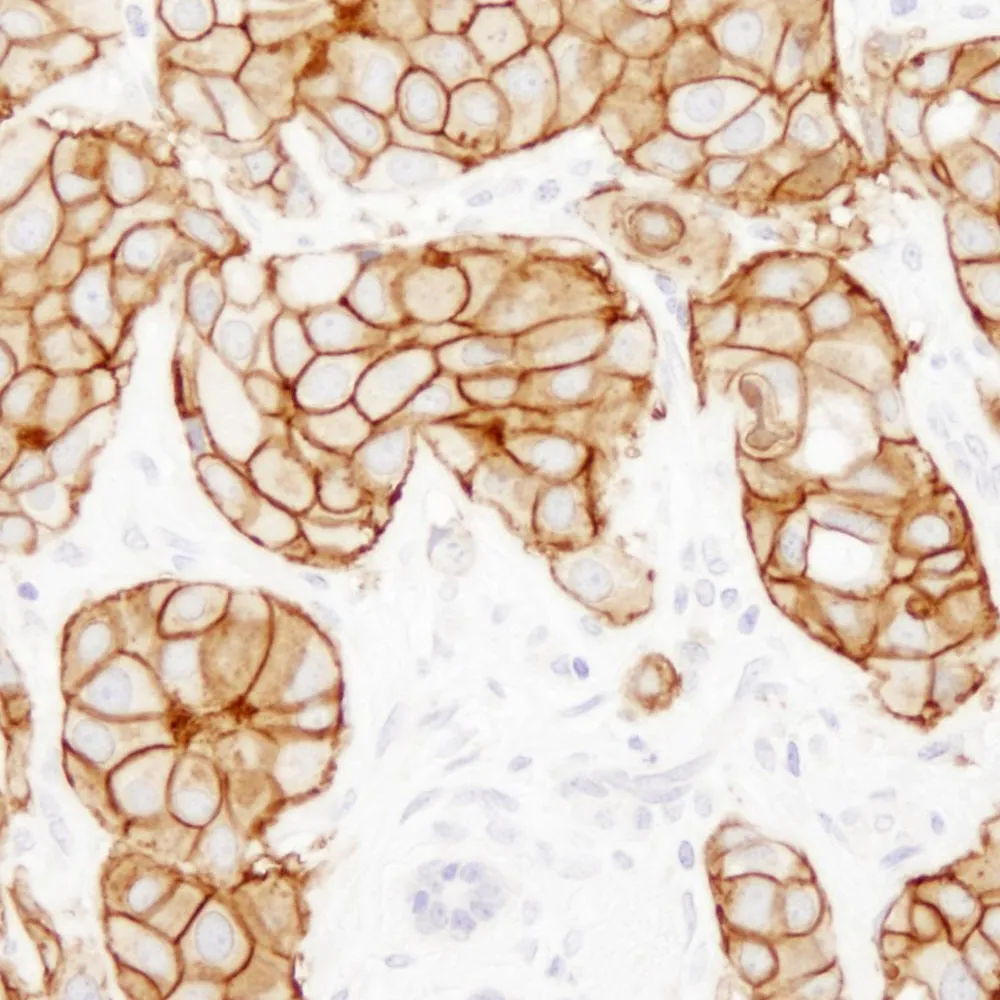 Rabbit anti-ErbB2 IHC Antibody, Affinity Purified