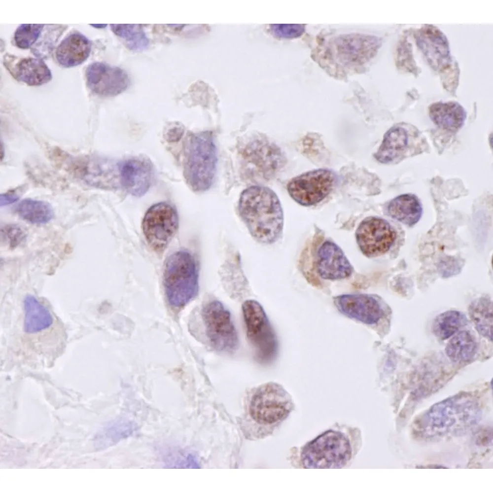 Rabbit anti-CKII alpha IHC Antibody, Affinity Purified