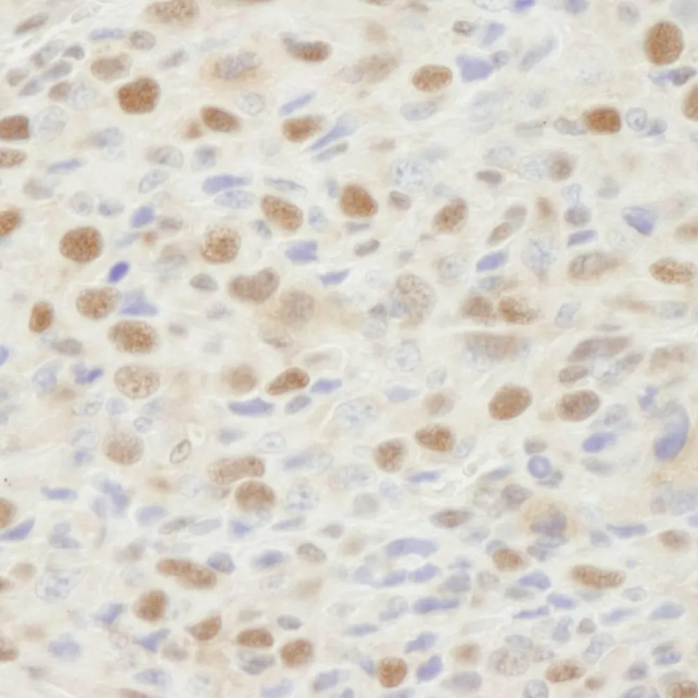 Rabbit anti-MSH2 IHC Antibody, Affinity Purified