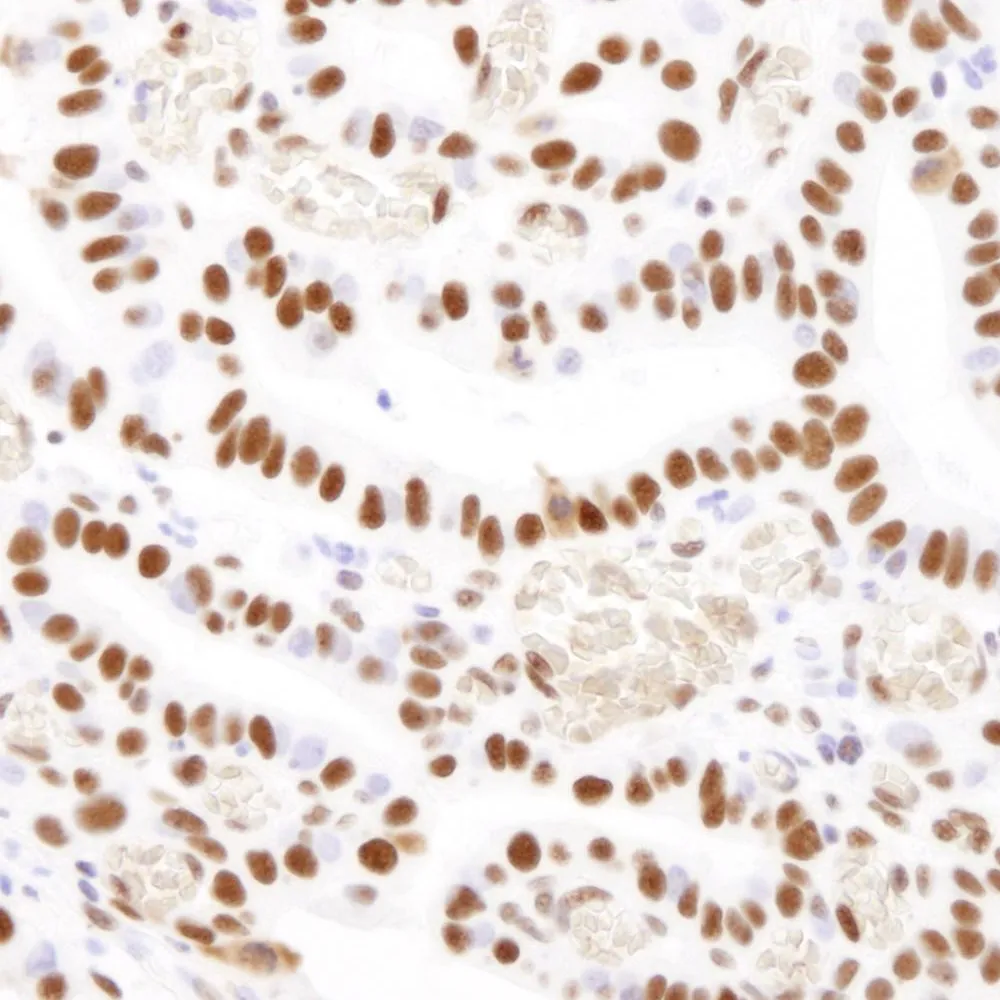 Rabbit anti-Nucleolin (NCL) IHC Antibody, Affinity Purified