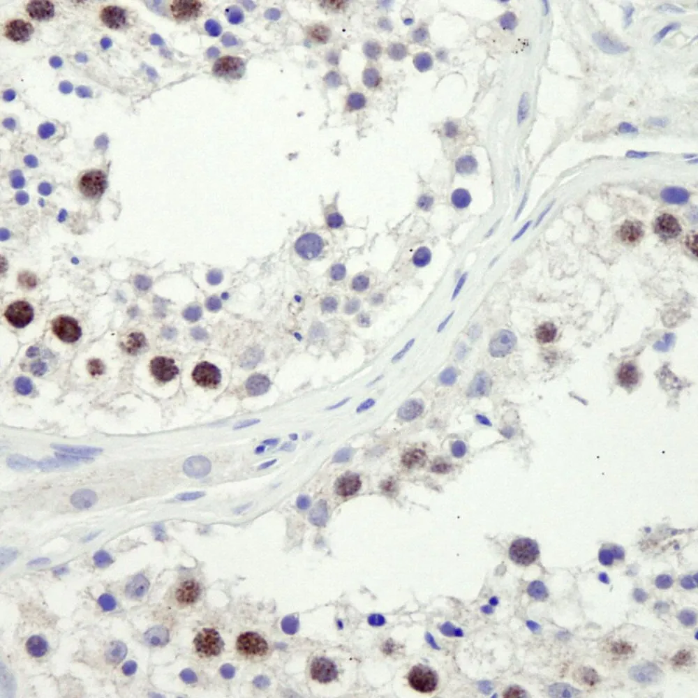 Rabbit anti-ZWINT-1 IHC Antibody, Affinity Purified