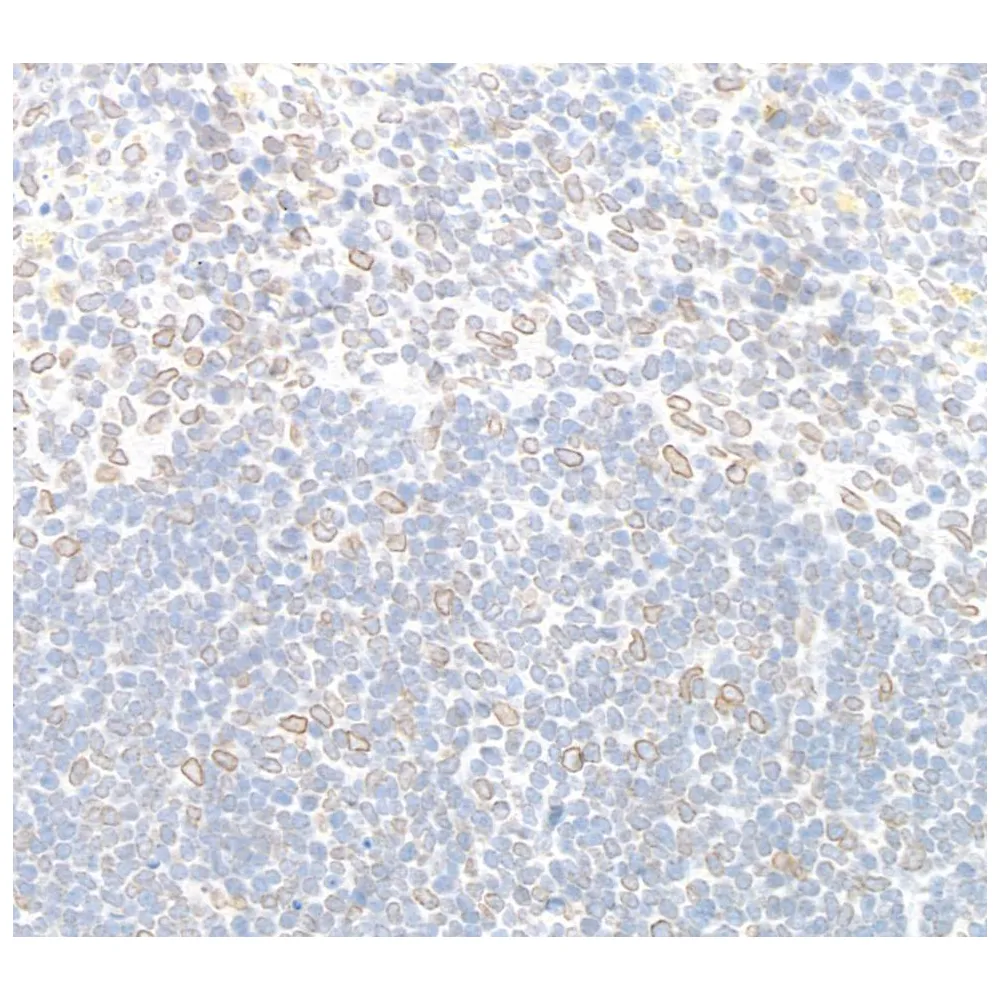 Rabbit anti-TPR IHC Antibody, Affinity Purified