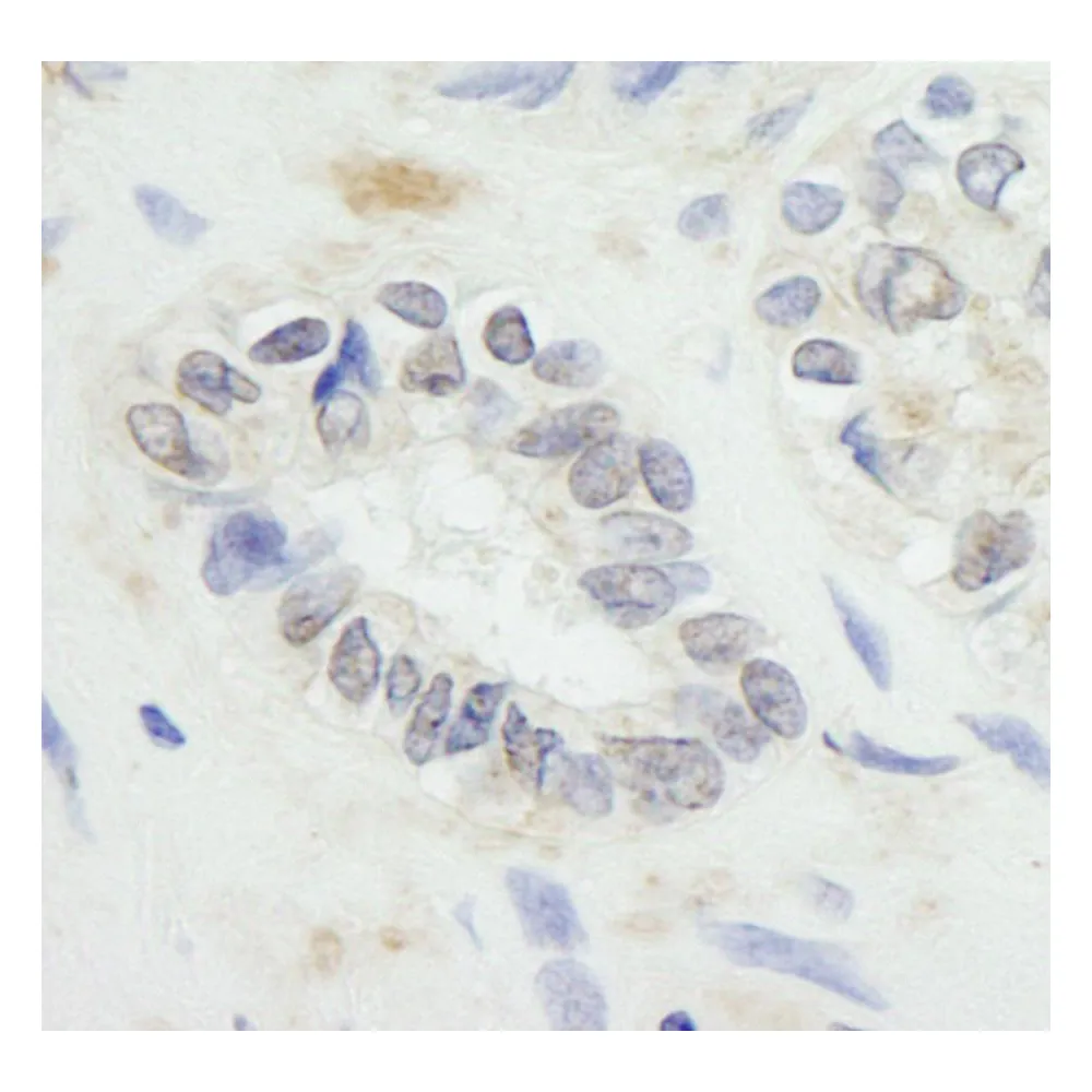 Rabbit anti-RNF20 IHC Antibody, Affinity Purified