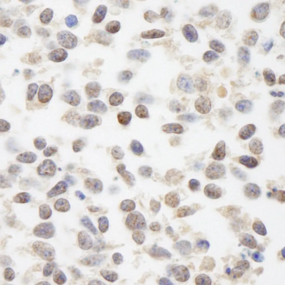Rabbit anti-BAAT1 IHC Antibody, Affinity Purified