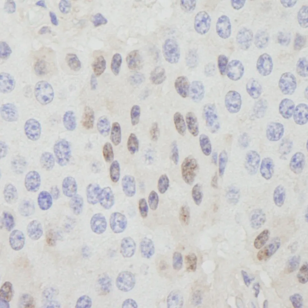 Rabbit anti-CDT1 IHC Antibody, Affinity Purified