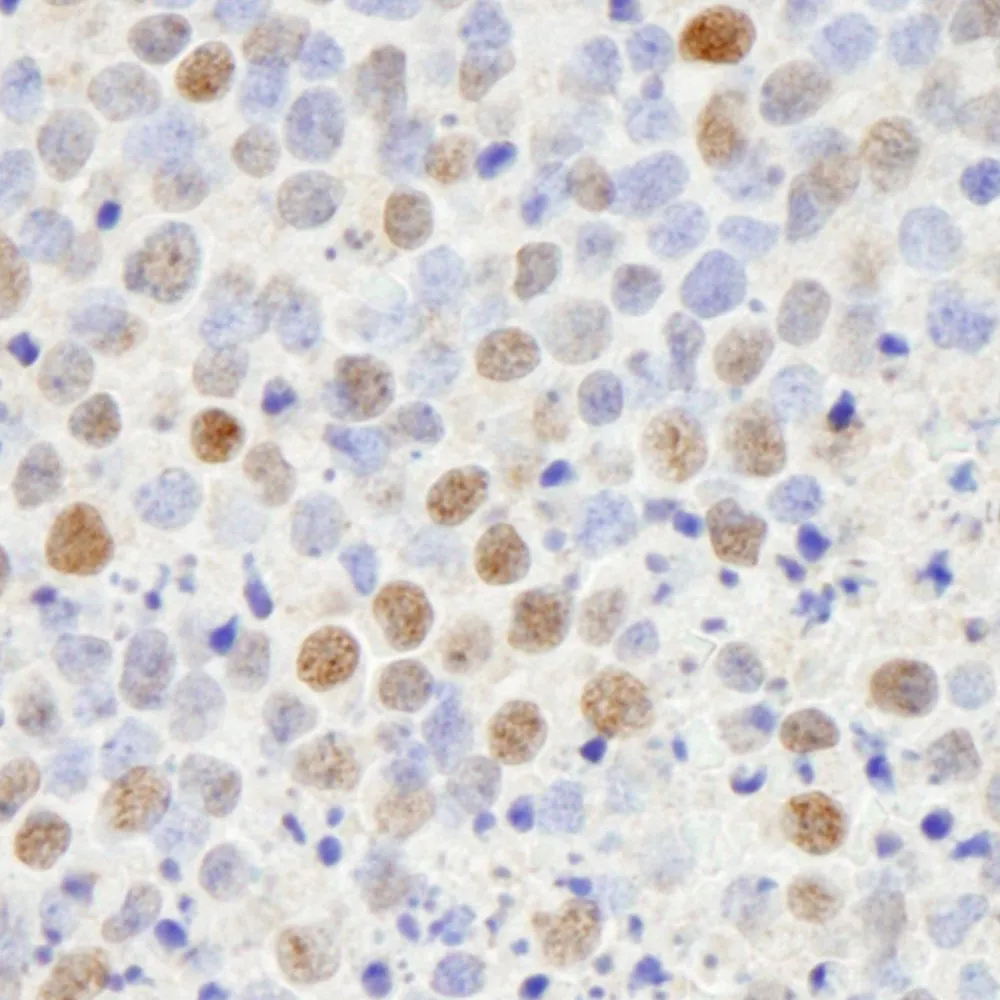 Rabbit anti-CBX5 IHC Antibody, Affinity Purified