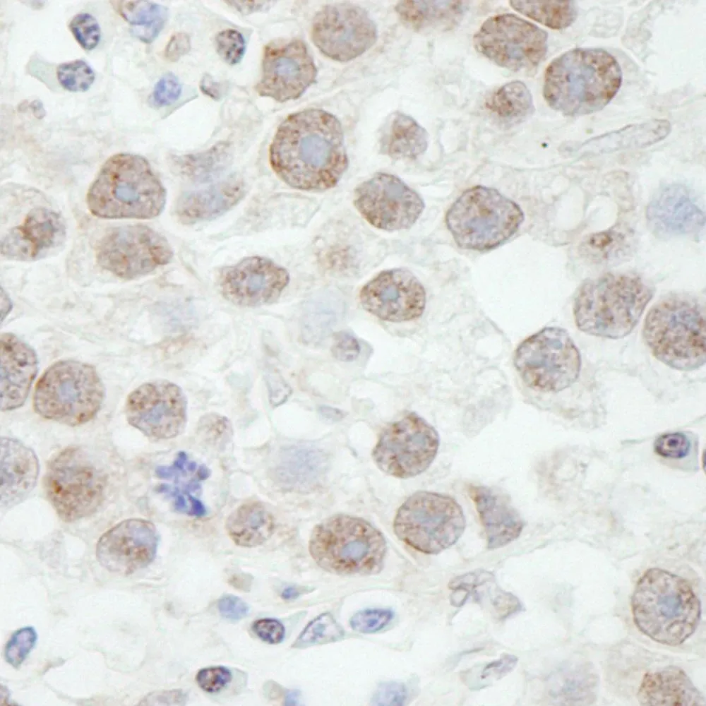 Rabbit anti-DDX17 IHC Antibody, Affinity Purified