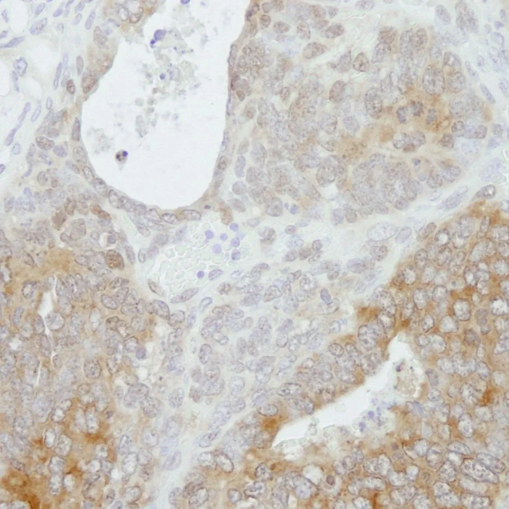 Rabbit anti-PRMT5 IHC Antibody, Affinity Purified