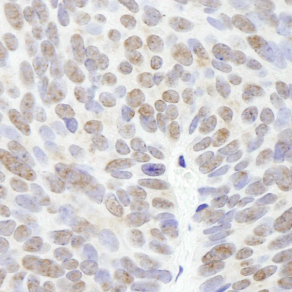 Rabbit anti-UBCH7 IHC Antibody, Affinity Purified