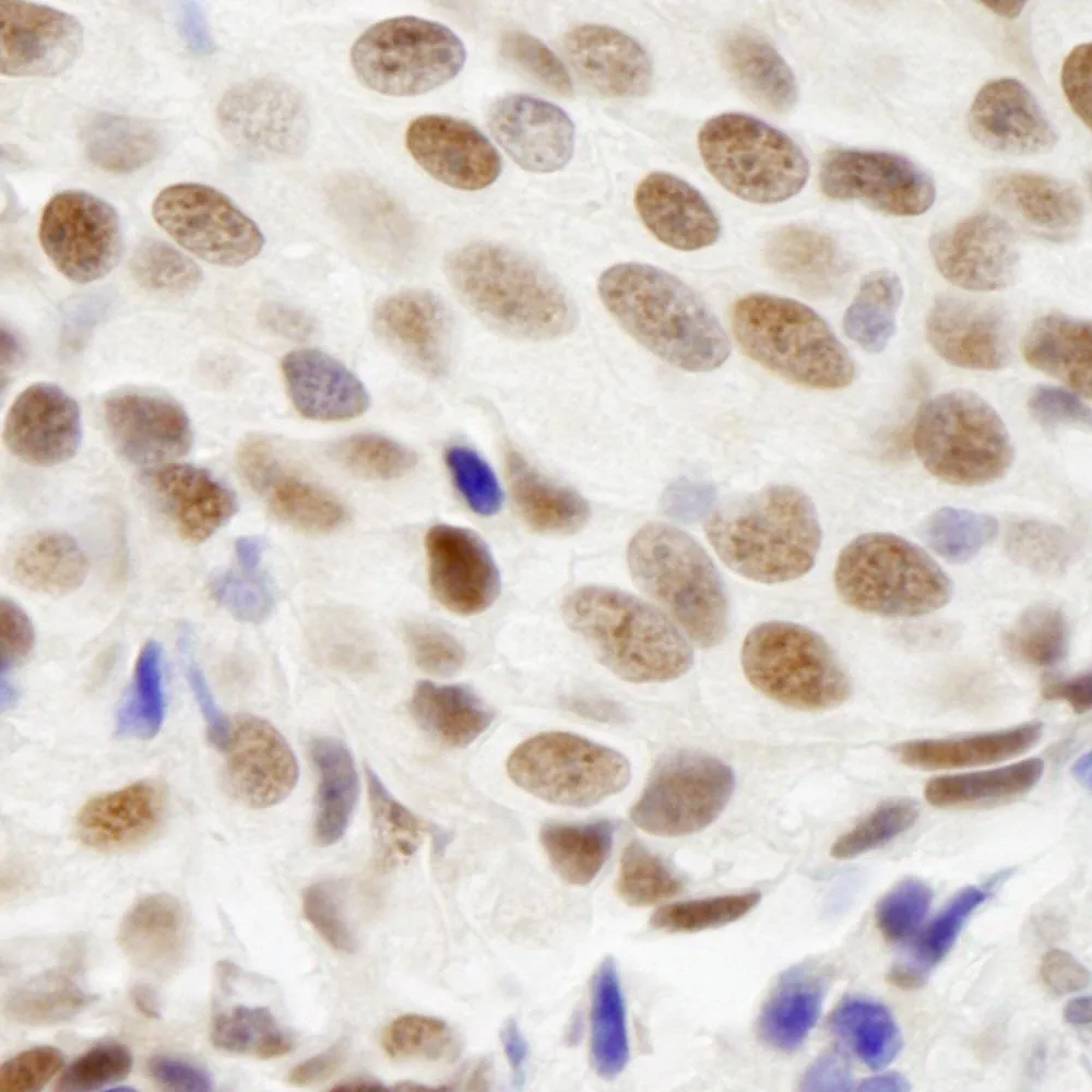 Rabbit anti-ZNF261 IHC Antibody, Affinity Purified