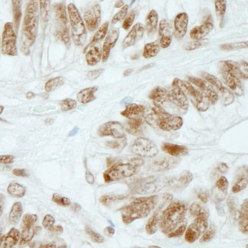 Rabbit anti-RbBP5 IHC Antibody, Affinity Purified