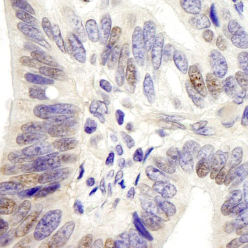 Rabbit anti-USP28 IHC Antibody, Affinity Purified
