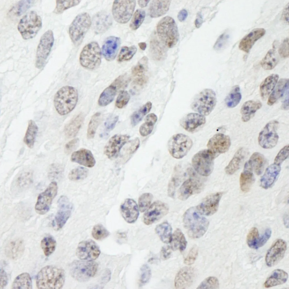 Rabbit anti-NONO IHC Antibody, Affinity Purified
